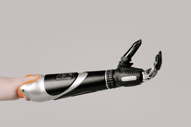 As AI technology continues to evolve, the future of bionic prosthetics looks incredibly promising.