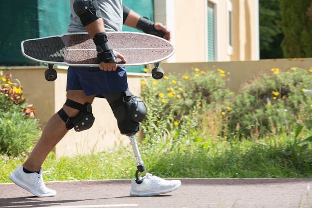 Artificial intelligence (AI) is revolutionizing prosthetics by making them more adaptive