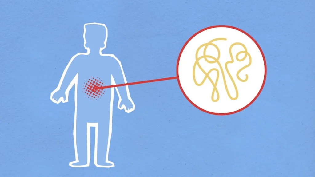 The gut plays a central role in overall health, yet many athletes overlook its impact on performance, recovery, and energy levels. For amputee athletes, gut health becomes even more critical as their bodies require optimal digestion and nutrient absorption to maintain endurance and muscle strength.