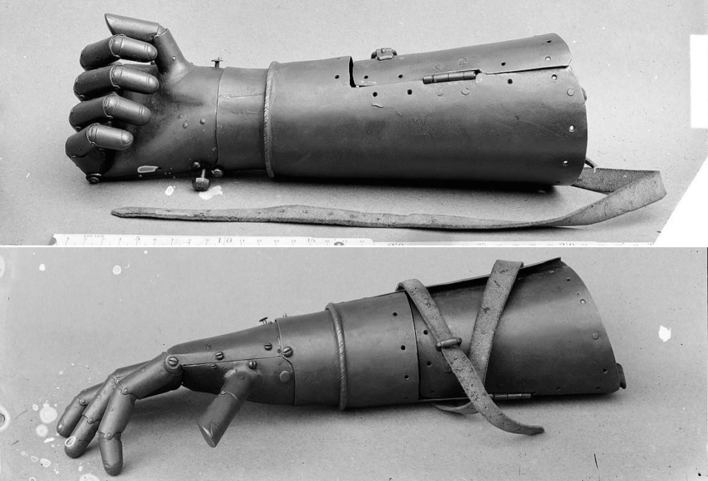 The Romans also created prosthetics for soldiers who lost limbs in battle. Historical records mention a Roman general named Marcus Sergius, who lost his right hand in combat but was fitted with an iron replacement that allowed him to hold his shield and continue fighting.