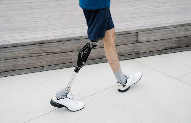You’ve trained, tested, and adapted. Now it’s time to make your prosthetic truly yours