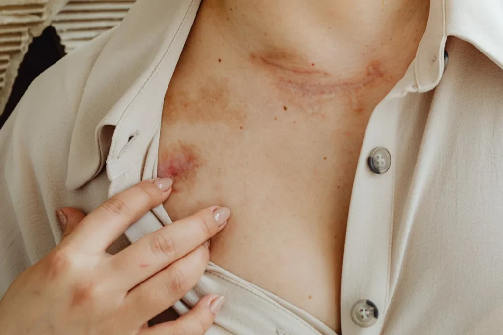 After an amputation, the emotional impact often hits harder and lasts longer than the physical pain. You’re not just dealing with the loss of a limb—you’re navigating a new identity, a changing body, and the often silent weight of grief. Many people describe feeling disconnected from their own body, like something vital has been taken away—not just in form, but in familiarity.
