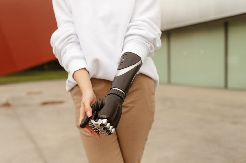 Most rehabilitation programs after limb loss
