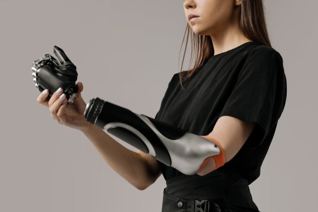 Fitting a bionic limb like Grippy™ 